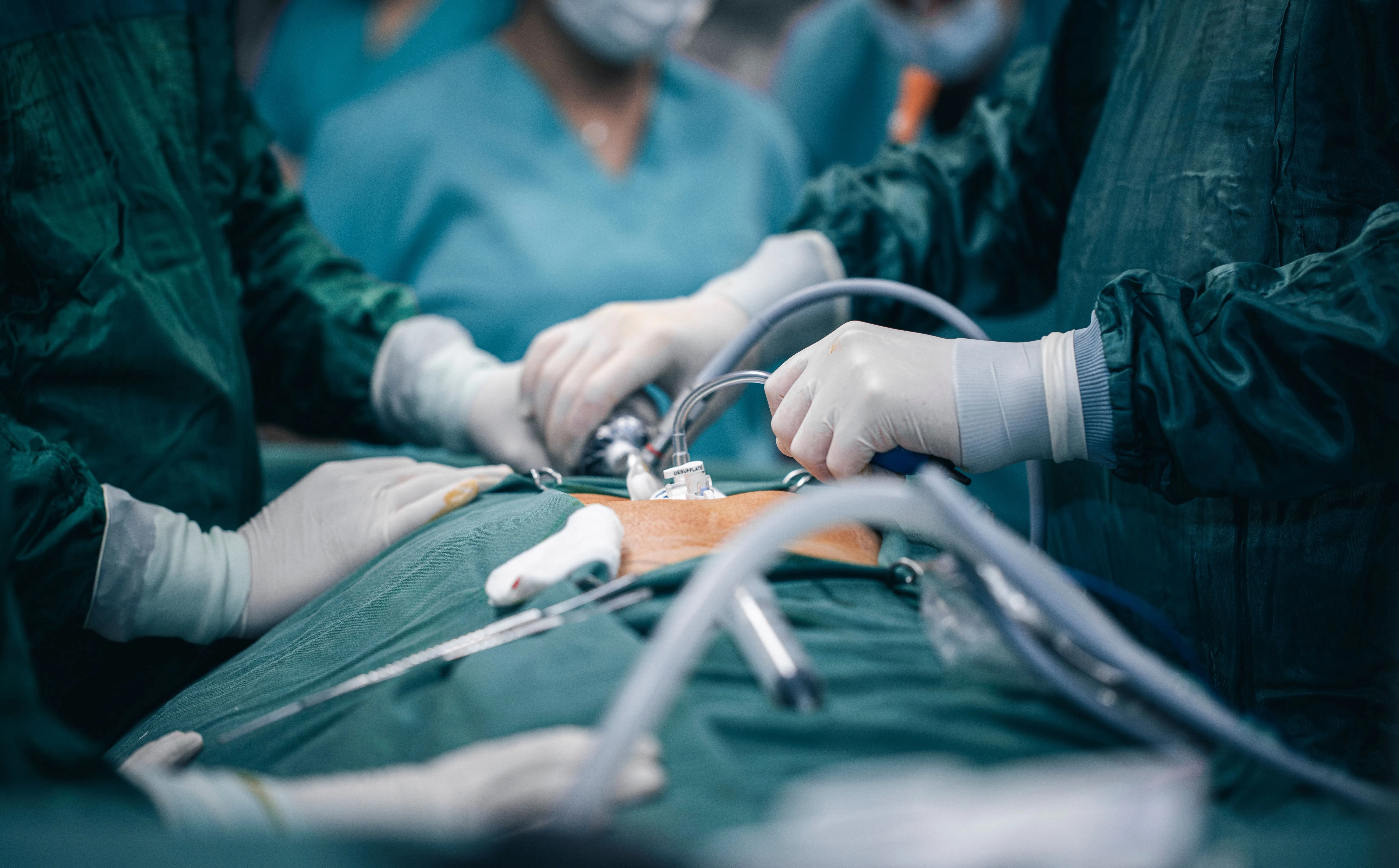 Acid Reflux Treatment in Abu Dhabi